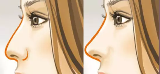 ά¡ǷЩ