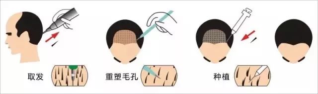 ѷôôƣ