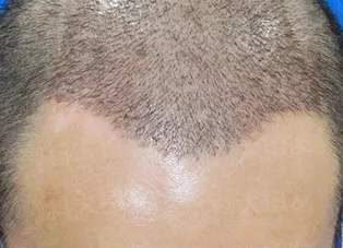 ΰΪֲ