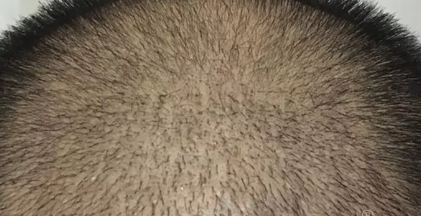 ںֲ3600ëҵλ