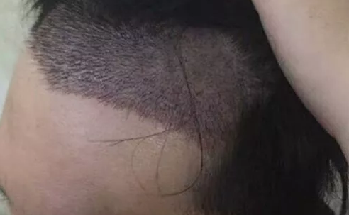 MѷļҽԺ