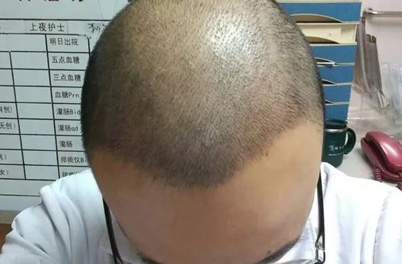 ݶѷֲļҺ?